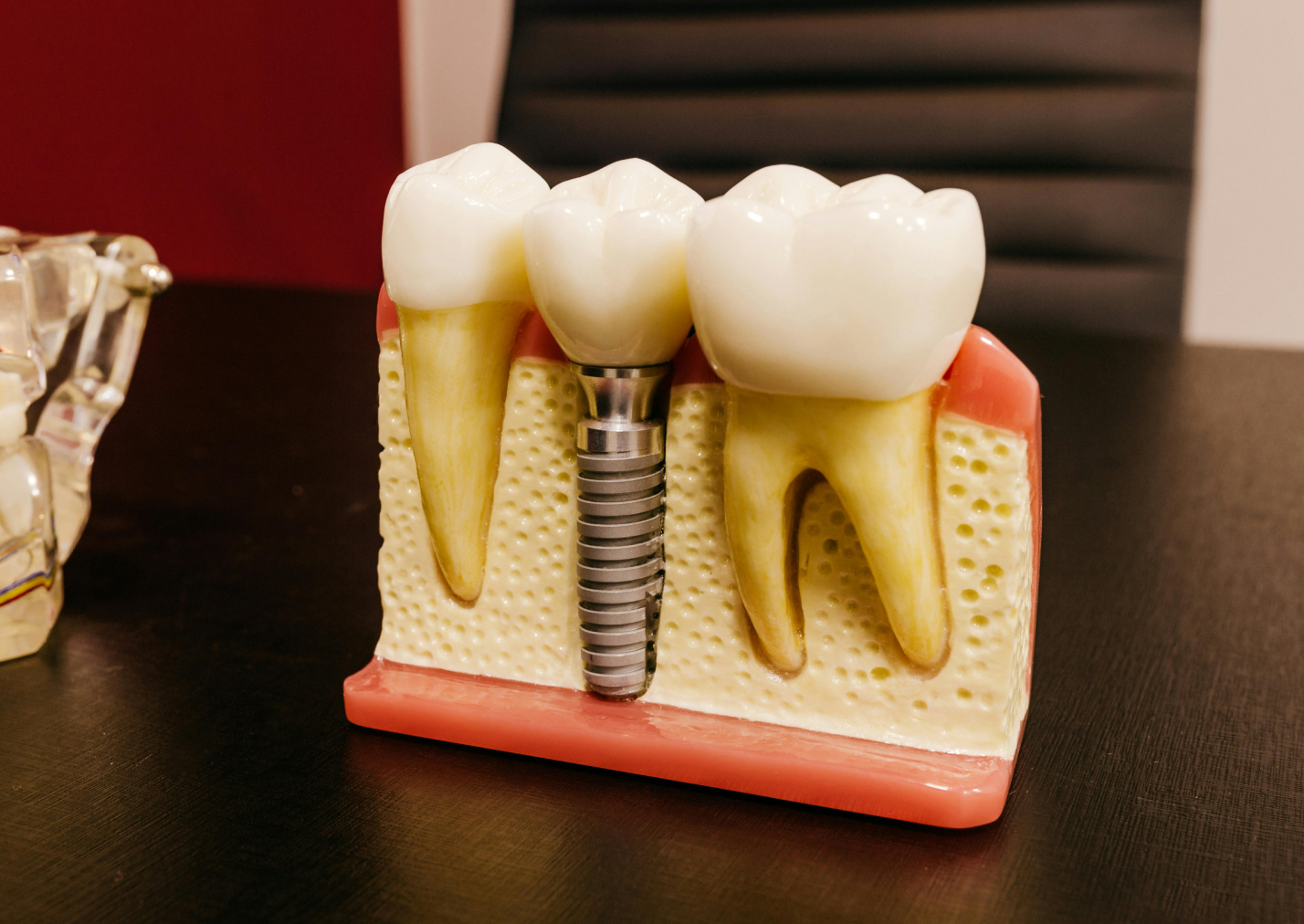 The Journey to a Confident Smile: Understanding Dental Implants - Blog - Naxis